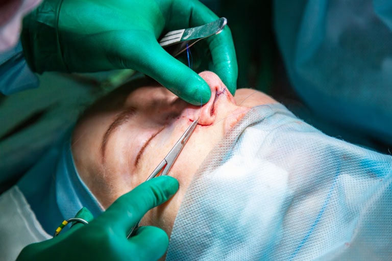 risk of rhinoplasty surgery